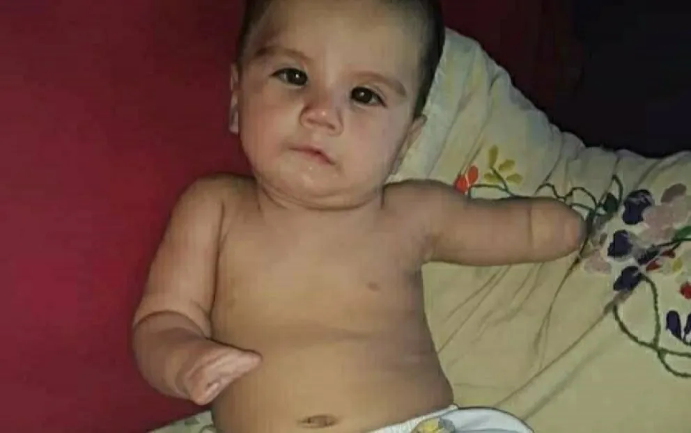 Nació sin un brazo, una pierna y una mano: su familia pide ayuda desesperada