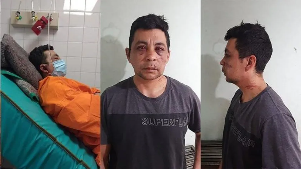 Murió el enfermero que fue linchado por contagiarse de Covid