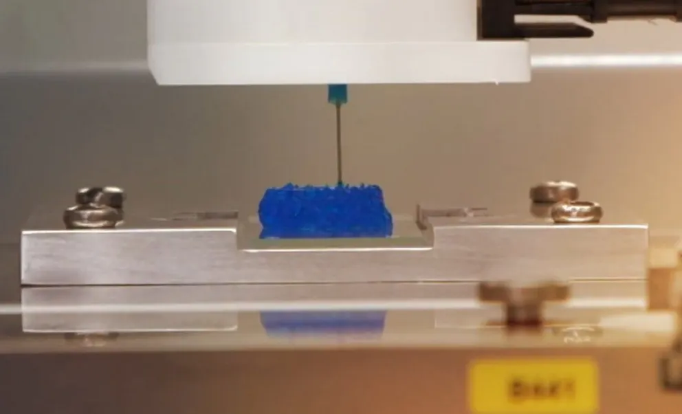 Expertos imprimen en 3D el primer tumor cerebral maligno activo  
