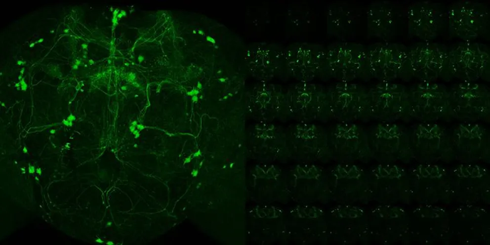 Un gen que regula el calcio en las neuronas podría jugar un rol clave en el Parkinson