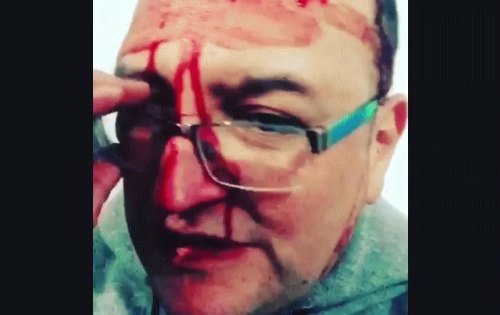 Apareció el video de la tremenda golpiza homofóbica que recibió Leo García