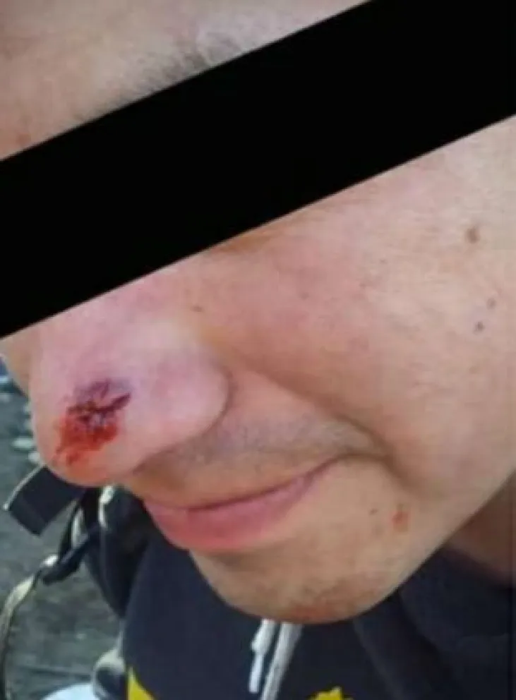 Denuncian que la Policía reprimió con balas de goma en la toma del cerro Otto