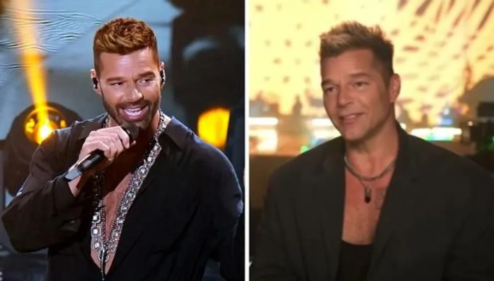 Ricky Martin habló sobre sus supuestos arreglos estéticos en la cara