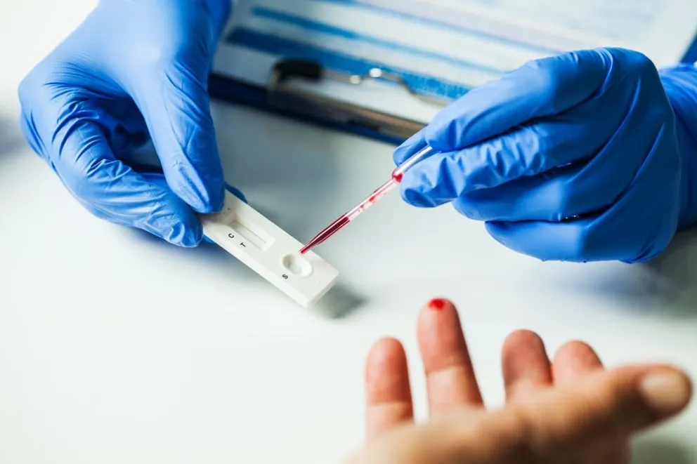La Anmat aprobó un test rápido que detecta anticuerpos en la fase temprana del virus
