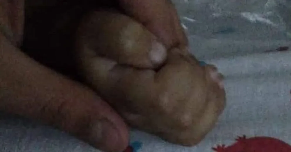 La bebé que cayó a una pileta en Lago Puelo ya está sin respirador