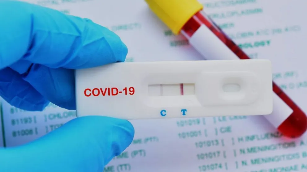 Test rápido de COVID-19: la ANMAT prohíbe la utilización de una marca