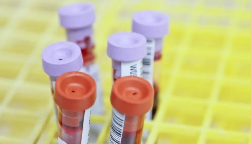 Desarrollan un test que permite detectar más de 50 tipos de cáncer: en qué consiste