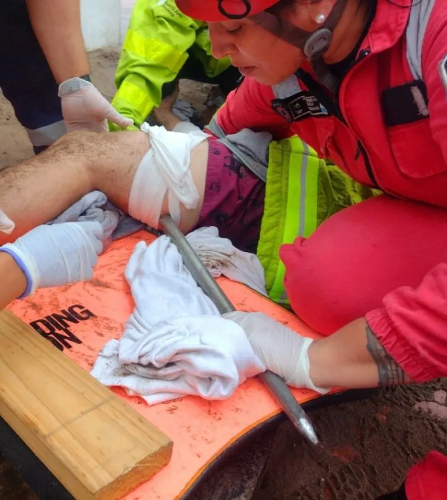 Peligro en la playa: Se voló una sombrilla y terminó clavada en la pierna de un joven