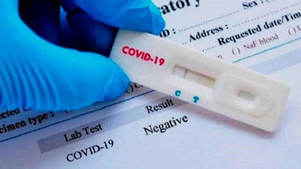 ¿Cuánto costarán los autotests de Covid 19 y dónde se podrán conseguir?