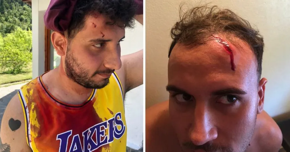 Agredidos en el corte de Ruta 40 del viernes mostraron sus heridas en las redes sociales