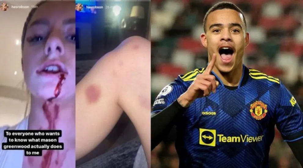 Polémica: un jugador del Manchester United fue detenido por una  denuncia de violencia de género