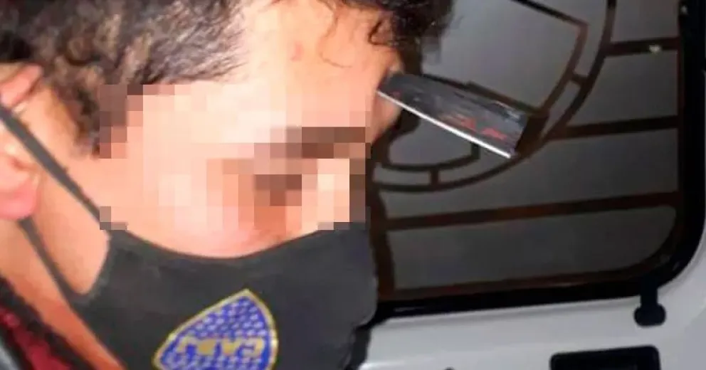 Le clavaron un cuchillo en la frente: Penas de cuatro años y de tres años y seis meses de prisión