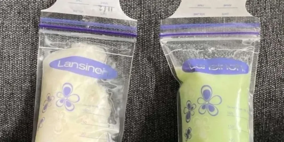 Leche verde: De qué se trata el síntoma que padecen algunas madres lactantes contagiadas de Ómicron