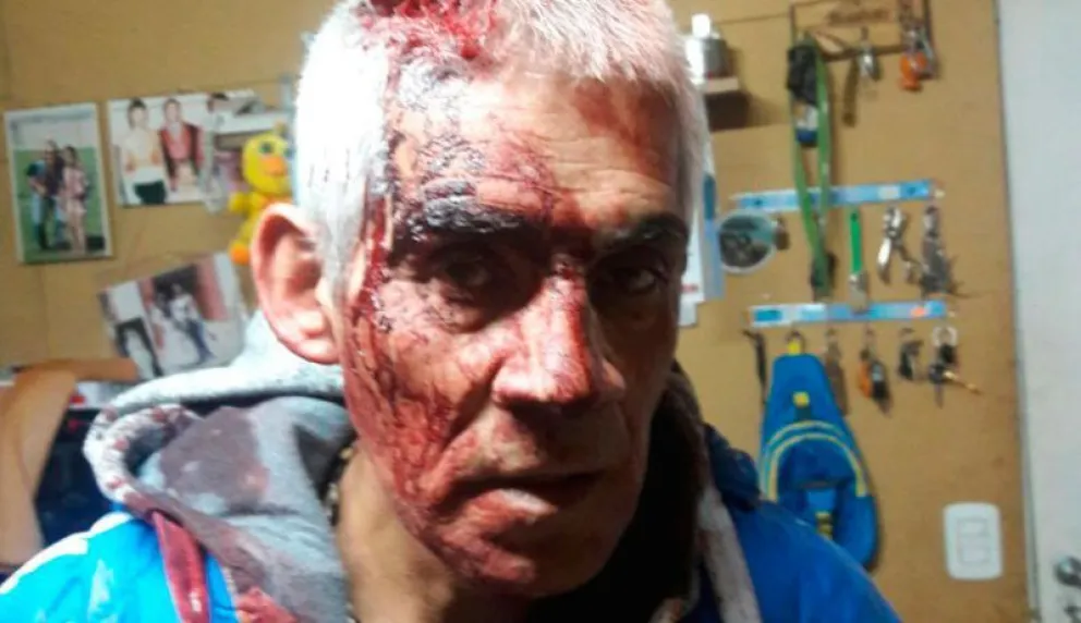 Intentan asaltar a reportero gráfico de El Cordillerano y lo agreden a culatazos