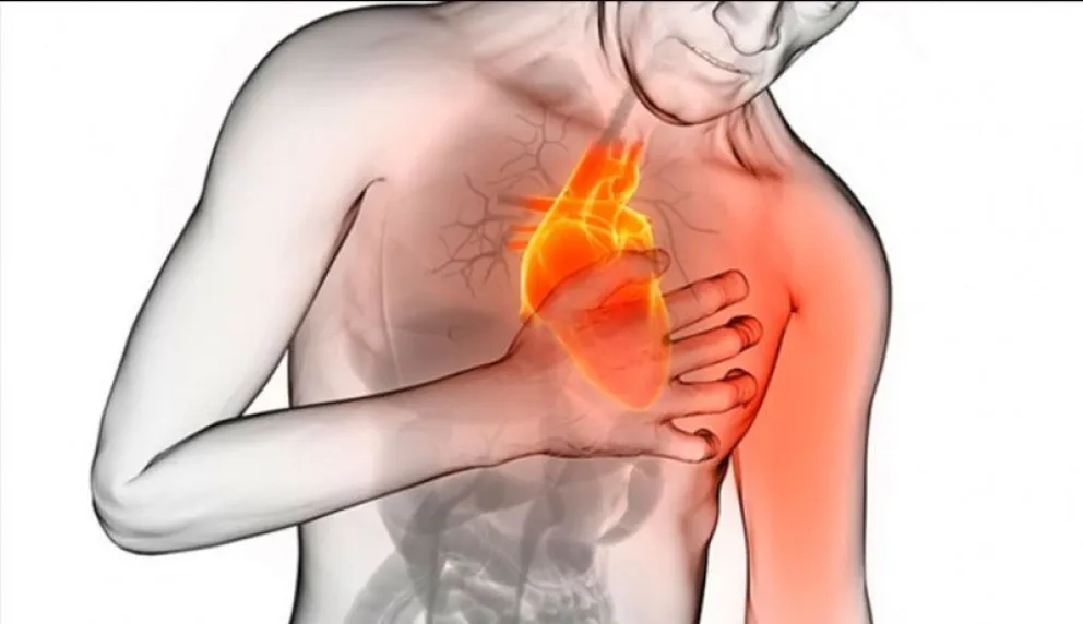 Interesante estudio de cardiólogos de Bariloche sobre infarto de miocardio