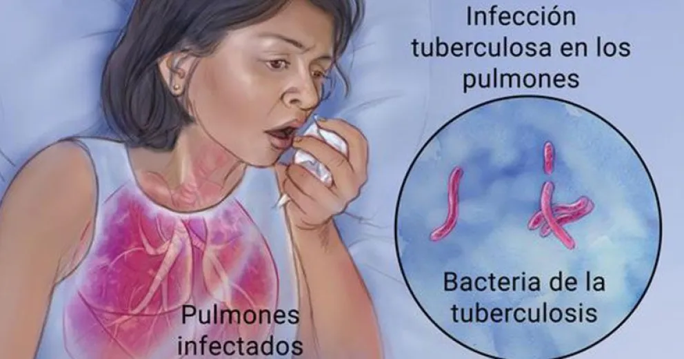 Reiteran en Río Negro el compromiso de poner fin a la tuberculosis