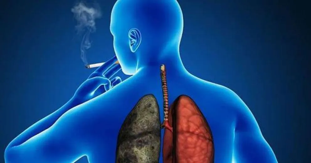 Logran reducir a la mitad riesgo de muerte en tipo más común de cáncer de pulmón