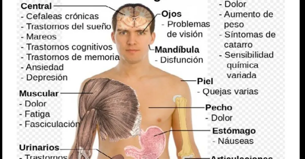 Fibromialgia: una enfermedad invisible