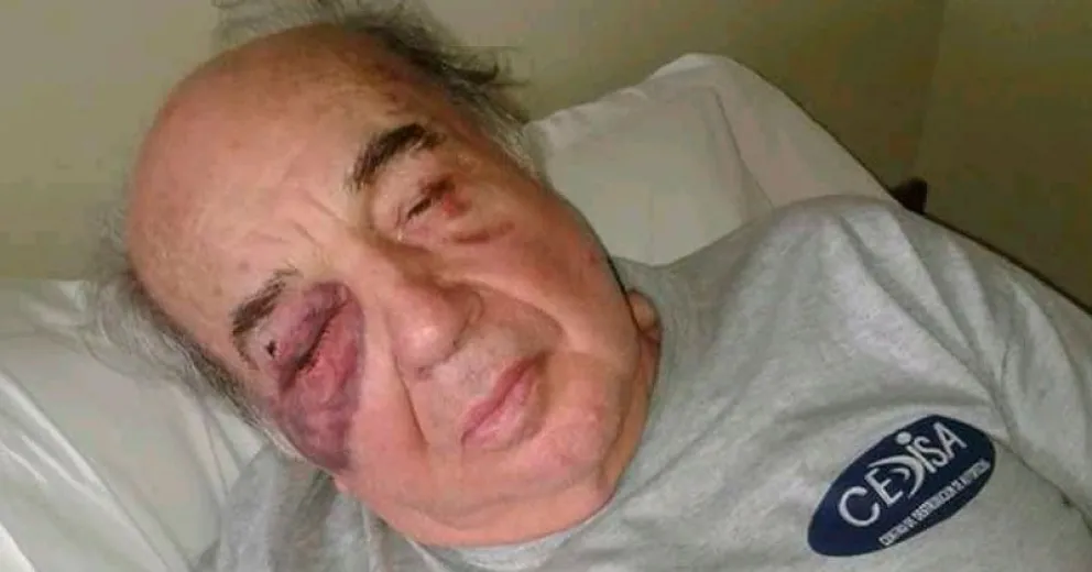 Golpearon brutalmente en la calle a un hombre mayor para robarle