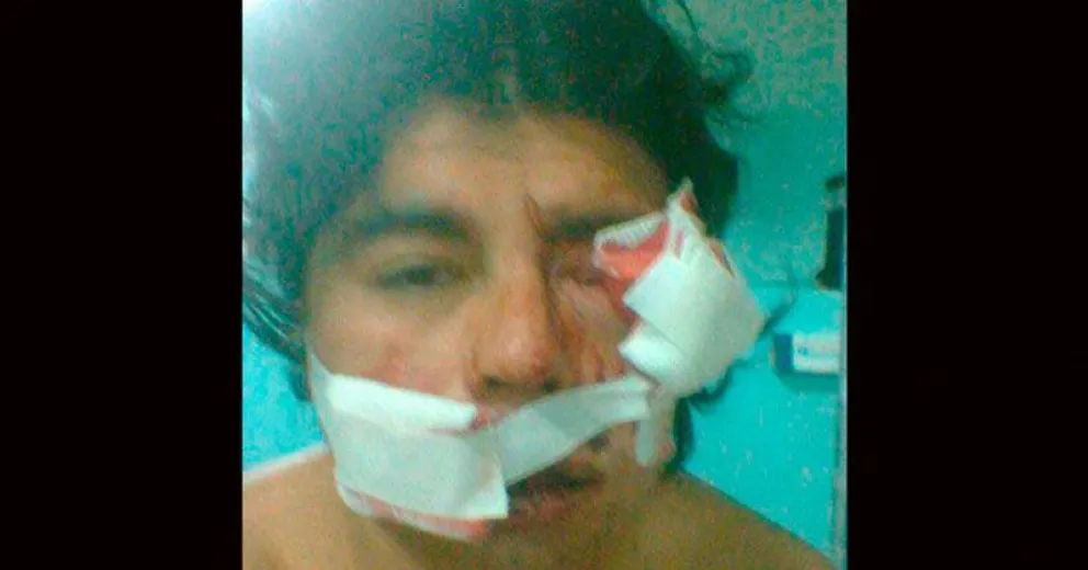 Confirmaron la absolución de un agente penitenciario que fue enjuiciado por las lesiones de un preso 