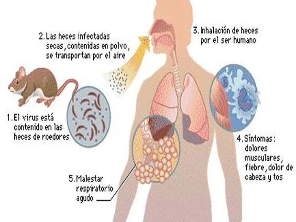 No olvidar las tareas de prevención ante el hantavirus