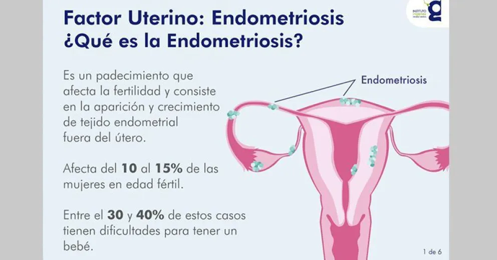 Endometriosis: una patología que lucha para ser visibilizada