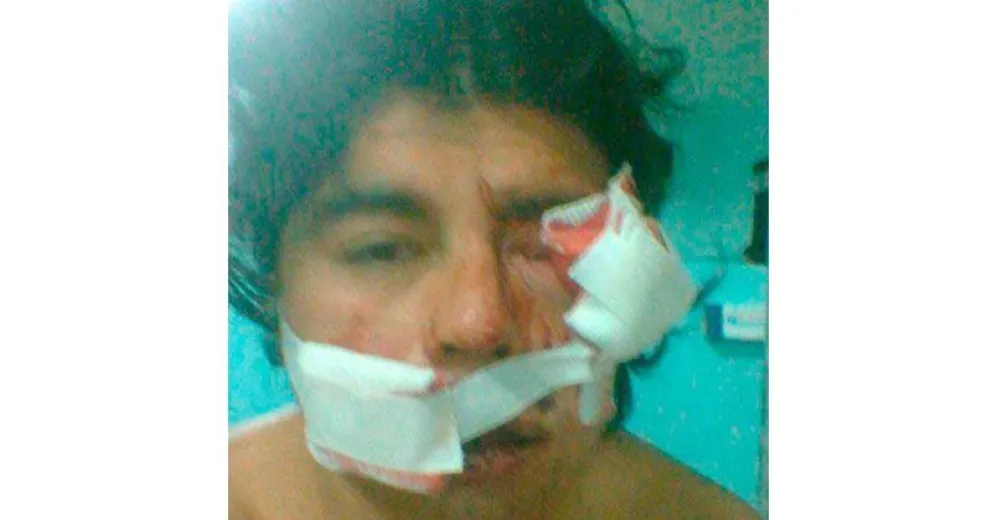 Un agente penitenciario irá a juicio por la pérdida de un ojo de un recluso