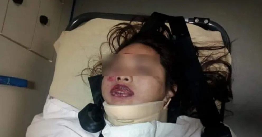 Una joven fue brutalmente golpeada a la salida de un boliche