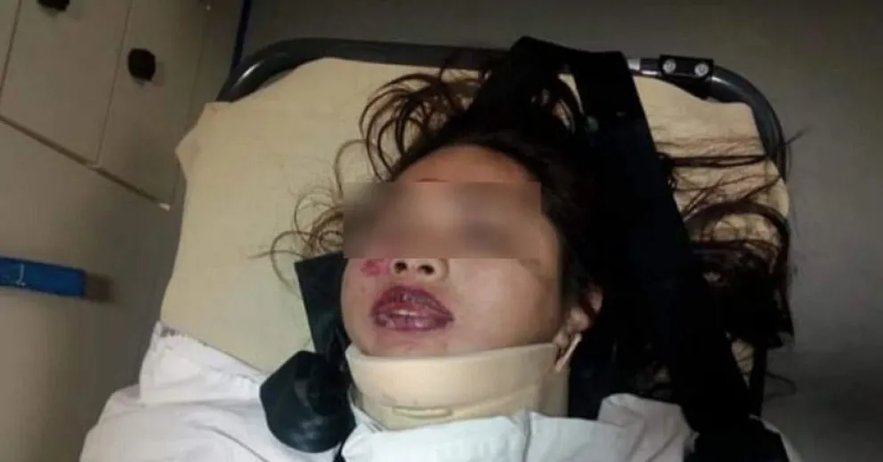 Imputaron a cuatro jóvenes que atacaron brutalmente a otra a la salida de un boliche