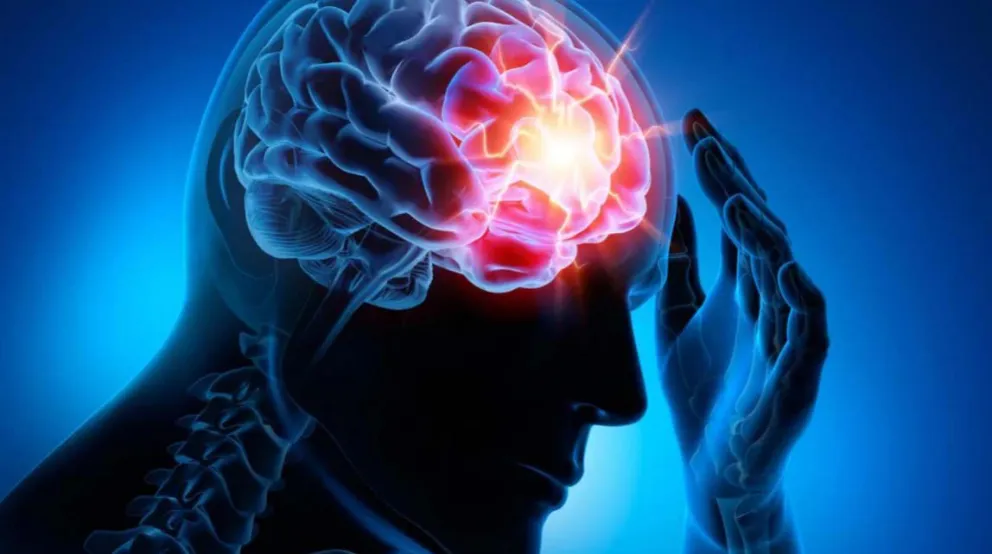 El accidente cerebrovascular se  puede prevenir con hábitos saludables