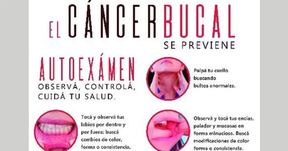 Salud realiza actividades para concientizar sobre la lucha contra el cáncer bucal