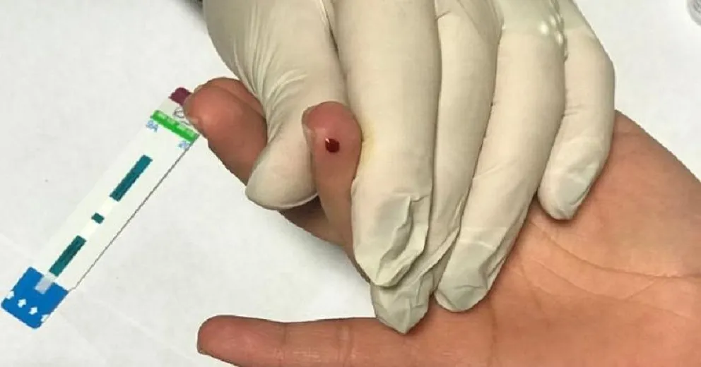 ¿Cómo es el test rápido de VIH?