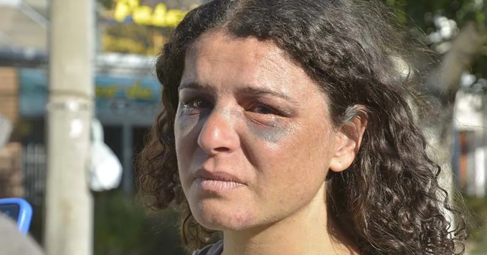 Tras ser víctima de un intento de femicidio,  marchó junto a la madre de Valeria Coppa