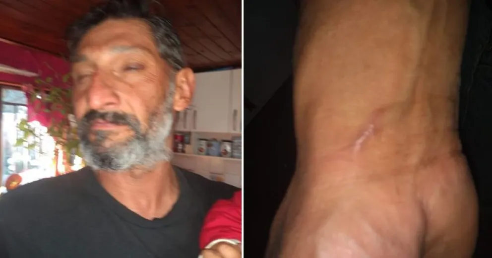 Denunció que fue agredido por la Policía  tras ser detenido por violar la cuarentena