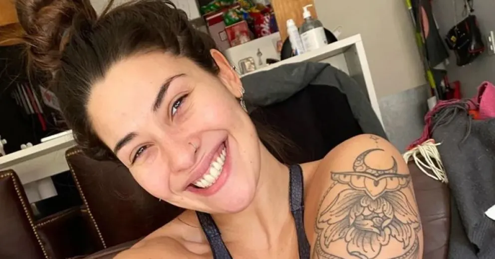 Ivana Nadal se sometió a una cirugía estética y mostró el resultado en las redes