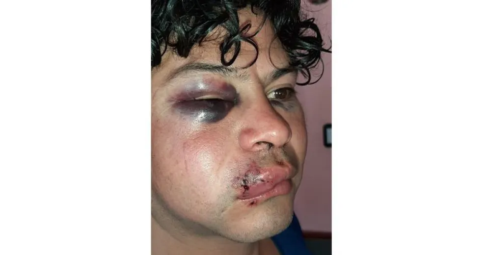 Un joven fue brutalmente golpeado por desconocidos y lo desfiguraron
