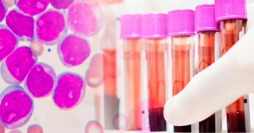 Aseguran que no hay forma de prevenir la leucemia, pero ayuda su detección temprana