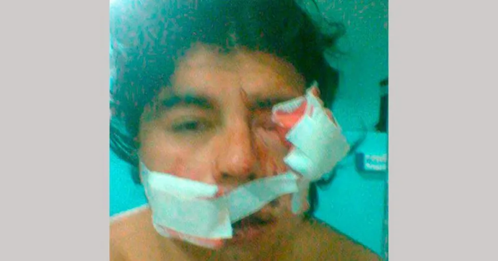 Agente penitenciario irá a juicio acusado de balear a un recluso durante una revuelta del Penal III