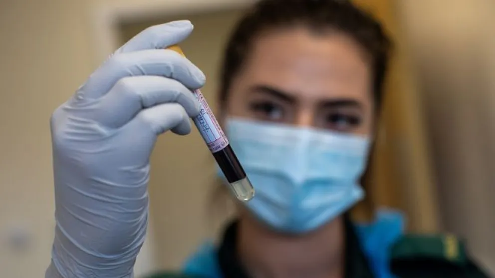 Covid-19: Revelan qué tipo de sangre es más resistente a la enfermedad