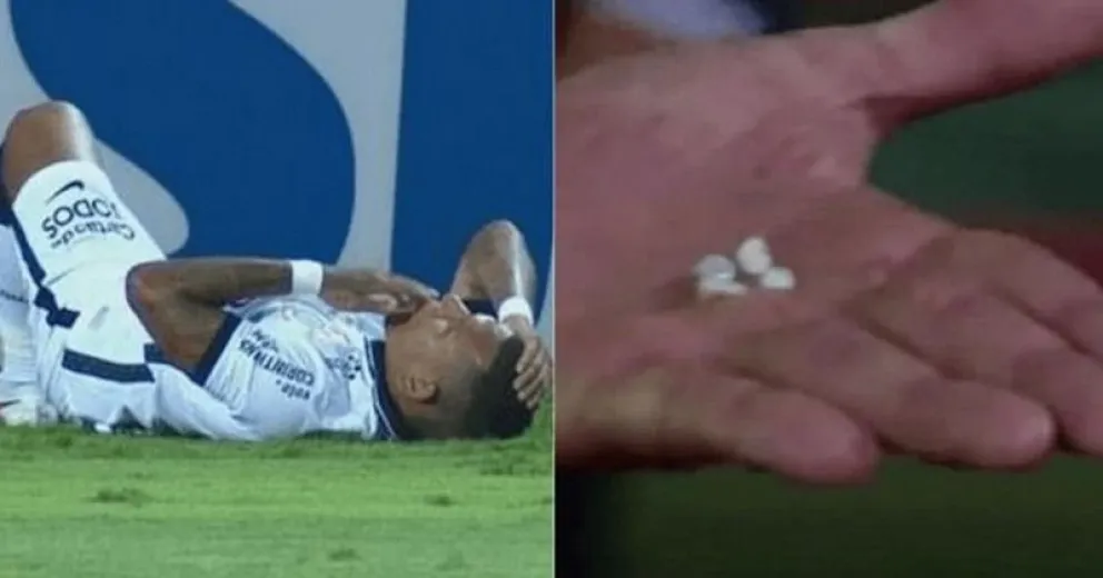 Un compañero y el árbitro le juntaron los dientes