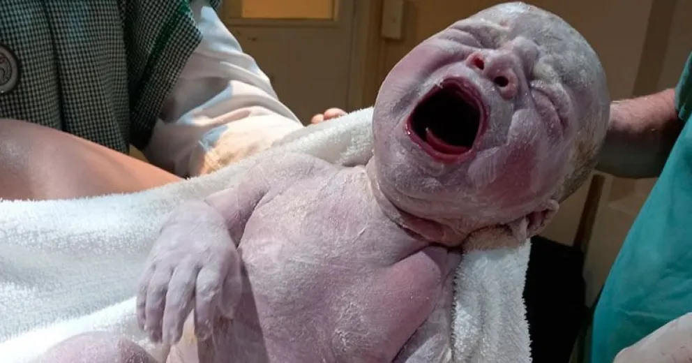 El amor de mamá y papá da casi un 80% de éxito en la recuperación del bebé