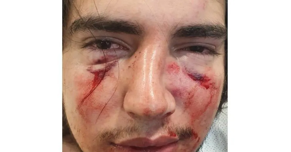 Cuatro jóvenes rugbiers denunciados por golpear a un chico