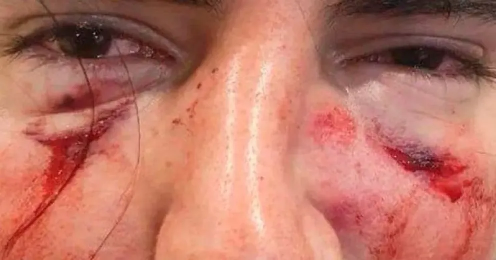 Suspendieron a dos rugbiers que golpearon salvajemente a un joven