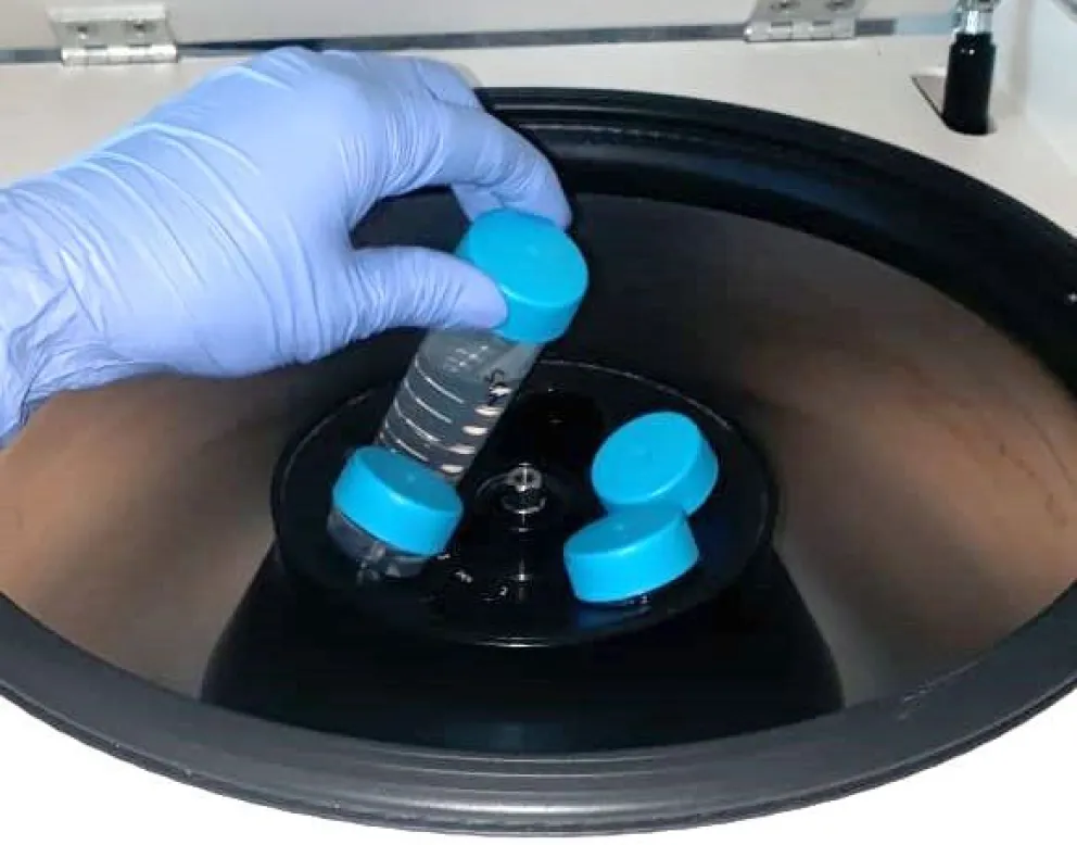 Miden niveles del coronavirus en aguas cloacales y recreativas