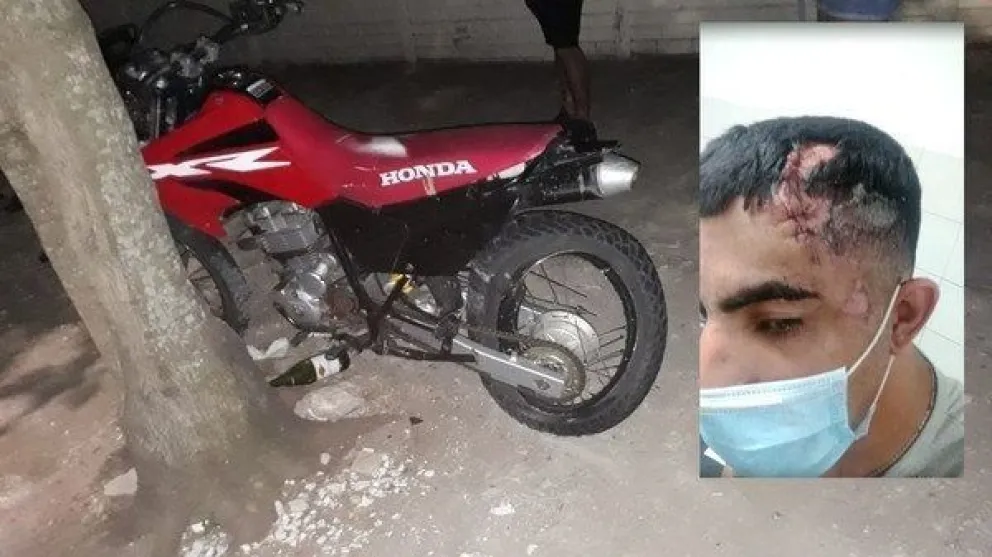Caso Píparo: video muestra cómo su pareja arrastra a motociclistas