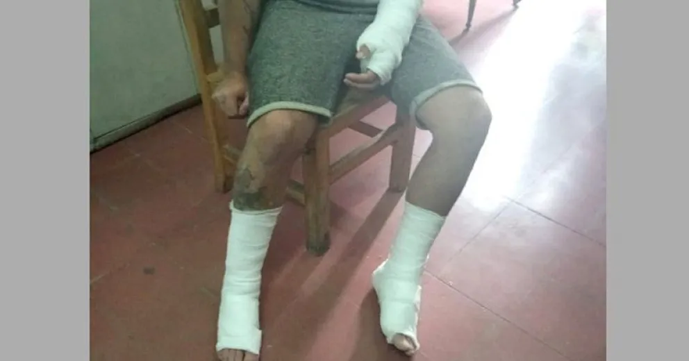 Capataz violento: tiró a un albañil desde un segundo piso por hacer mal una losa
