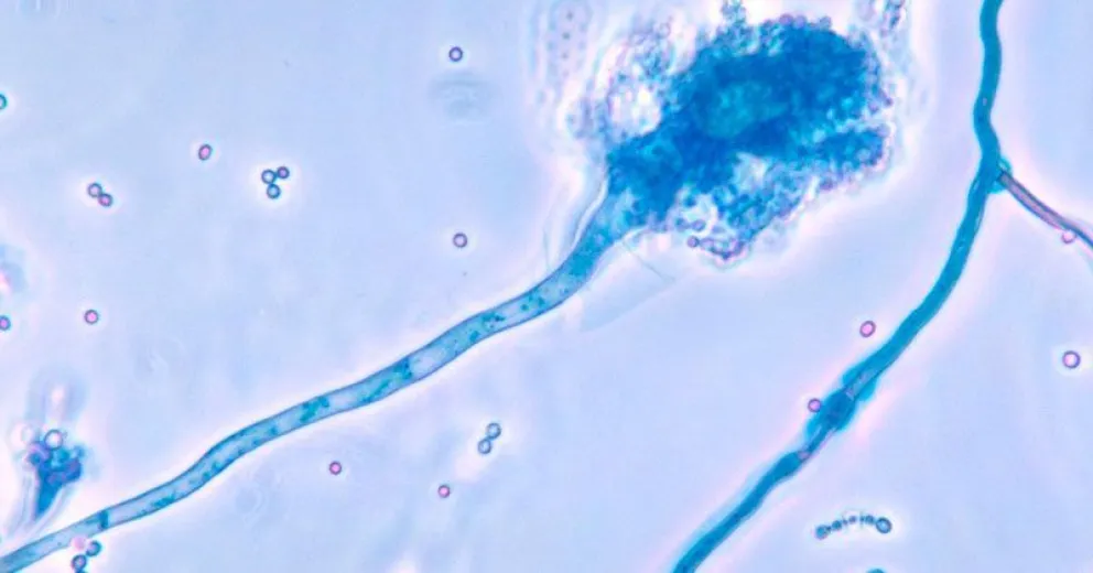 Afirman que hay 55 especies de hongos que provocan enfermedades cerebrales
