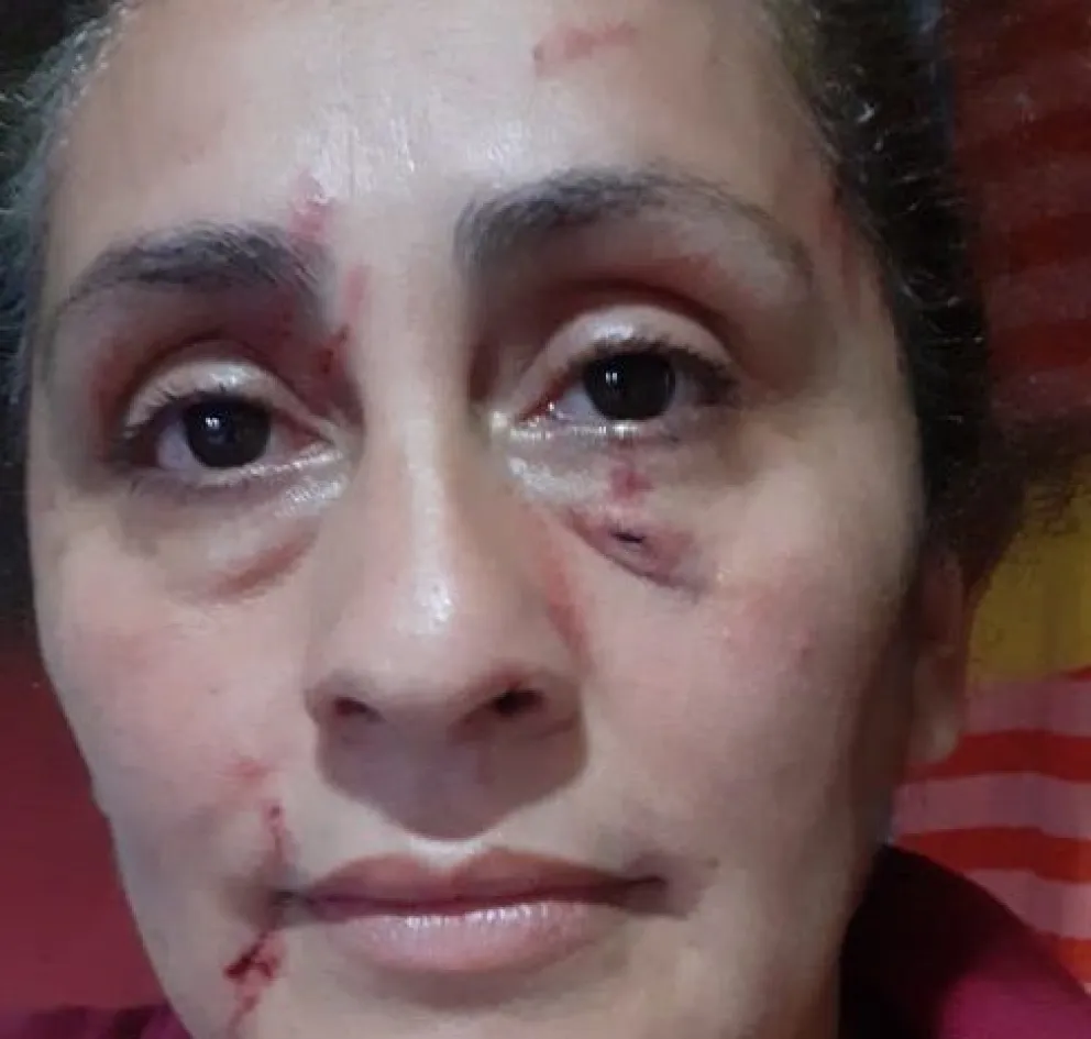 Madre del agresor de La Angostura dice que la violenta es la mujer