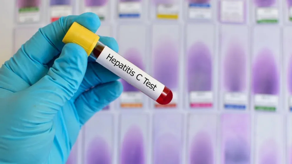 Hepatitis C: estudios indican que se podrá donar y recibir un trasplante