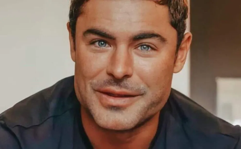 ¿Qué le pasó en la cara? El tremendo cambio de Zac Efron 